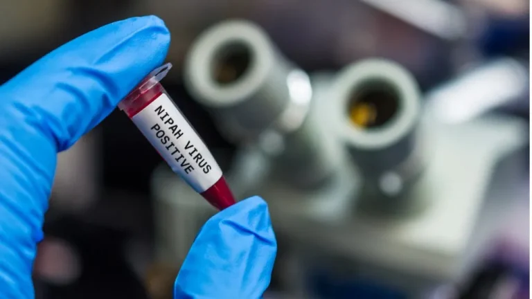 Virusul Nipah: cum se manifestă și cum ne protejăm. Recomandările ANSP