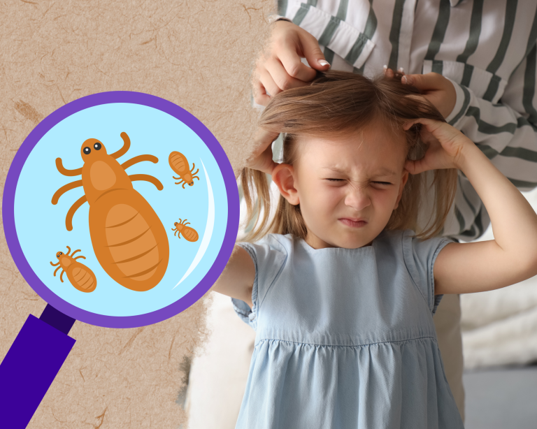 Păduchii: de unde vin, cum se răspândesc și cum îi combatem