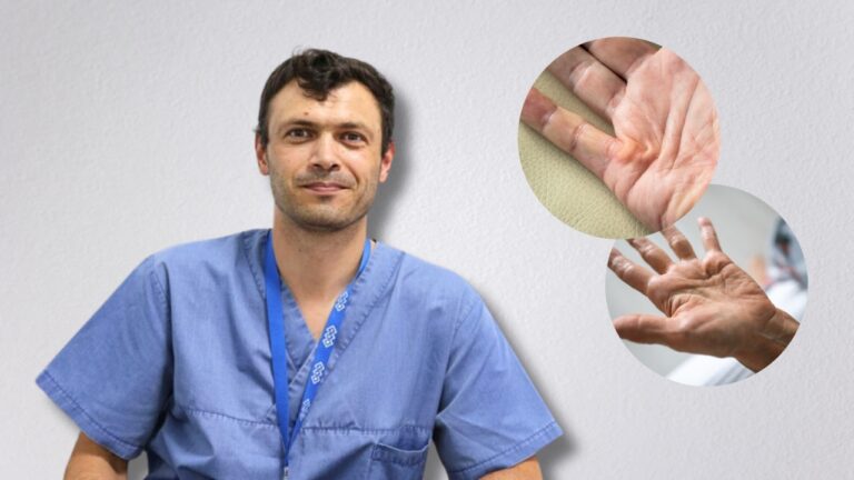 Maladia Dupuytren: de ce se blochează degetele în palmă și cum poate fi tratată. Explicațiile medicului