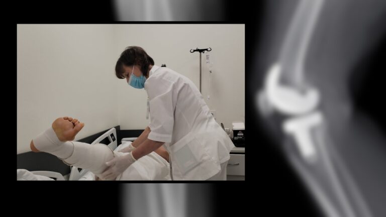 Ce trebuie să știe pacienții după protezarea genunchiului. Explicațiile kinetoterapeutei